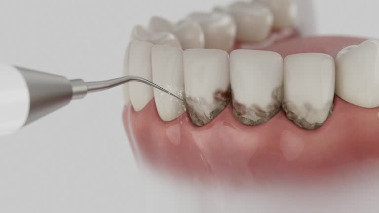 Trusted Root Canal Treatment service in Ladd, IL - Dentist Open Now